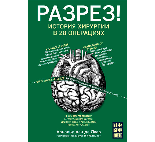 Разрез! История хирургии в 28 операциях ван де Лаар А.